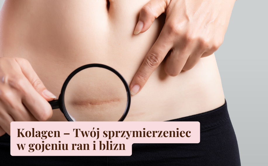 Kolagen &ndash; Tw&oacute;j sprzymierzeniec w gojeniu ran i blizn
